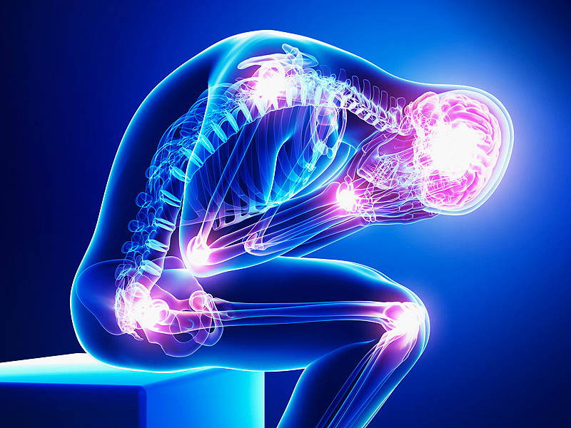 Can Long-term Pain Be Prevented?